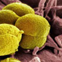 gonorrhea-bacteria